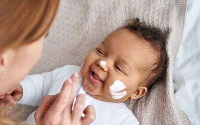 Spädbarn som smörjdes med hudkräm hade mer allergier i treårsåldern